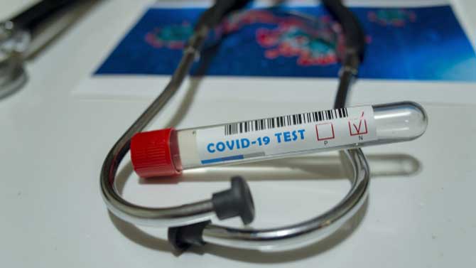 Prueba de la Covid-19.