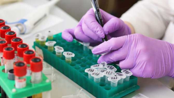 An&aacute;lisis de pruebas en laboratorio.